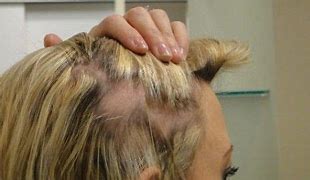 Hair Damage